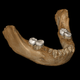 Virtual computer reconstruction of the Xiahe mandible, with layer of carbonate crust digitally removed.